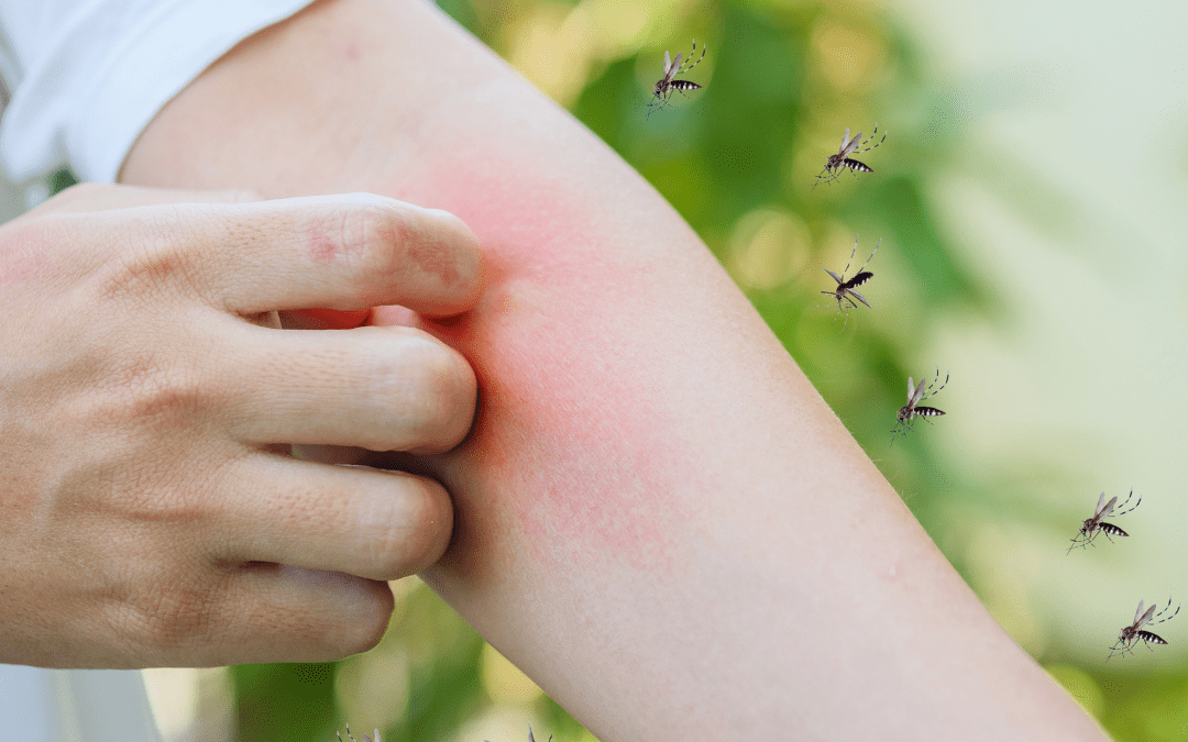 Best Mosquito Control for Yards & Prevention Tips for Mosquitoes